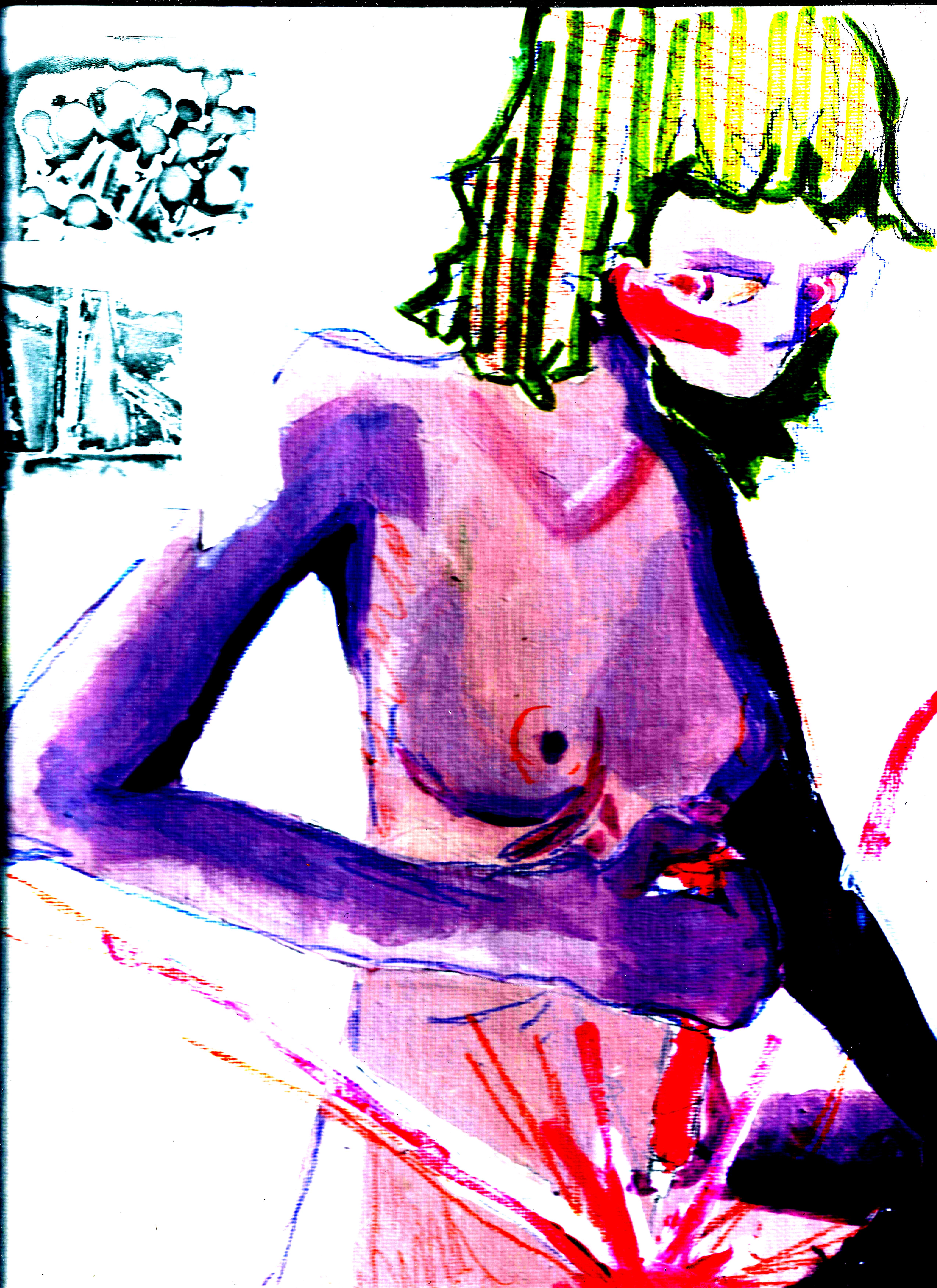 missing img